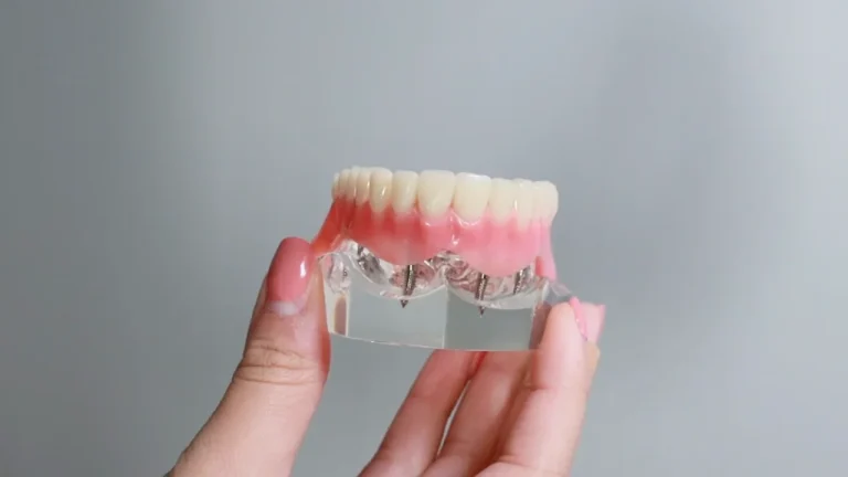 Navigating Teeth Implants Price: A Guide to Risk, Value, and Decision Clarity